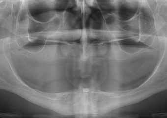 Raio x inicial - Clínica Cliniface