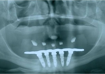 Raio x final  - Clínica Cliniface