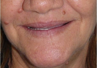  - Clínica Cliniface