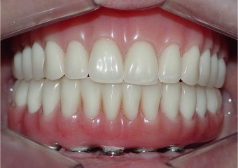 Imagem final - Clínica Cliniface