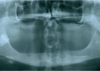 Raio x inicial - Clínica Cliniface