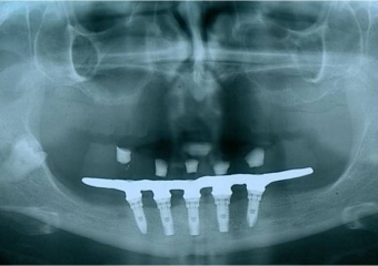 Raio x final  - Clínica Cliniface