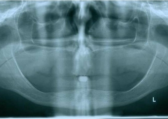 Raio x inicial - Clínica Cliniface