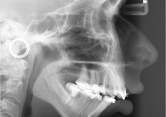 Telerradiografia inicial - Clínica Cliniface