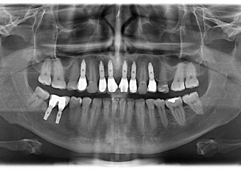 Raio X final - Clínica Cliniface
