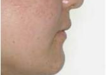 Perfil final - Clínica Cliniface