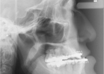 Telerradiografia inicial - Clínica Cliniface