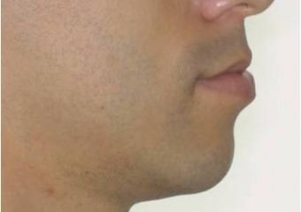 Perfil inicial - Clínica Cliniface