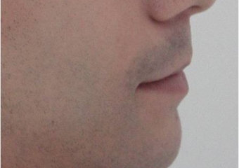 Perfil final - Clínica Cliniface