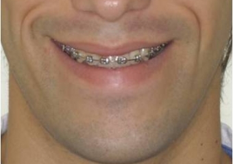 Imagem inicial com assimetria de face - Clínica Cliniface