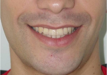 Imagem final - Clínica Cliniface