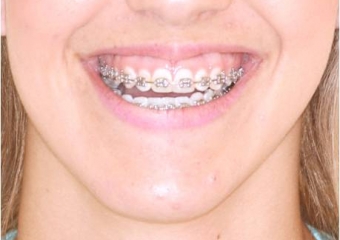  - Clínica Cliniface