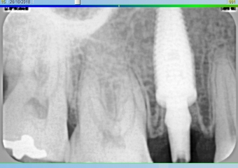 Rx Imediato - Clínica Cliniface