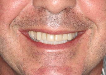 Foto extra oral final  - Clínica Cliniface