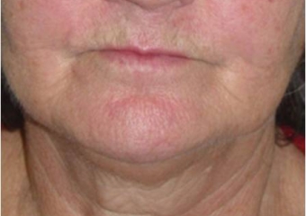 Imagem inicial - Clínica Cliniface