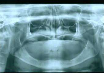 Raio x inicial - Clínica Cliniface