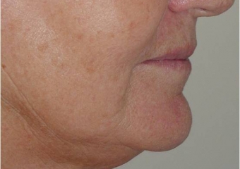 Perfil final - Clínica Cliniface