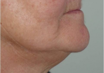 Perfil inicial - Clínica Cliniface