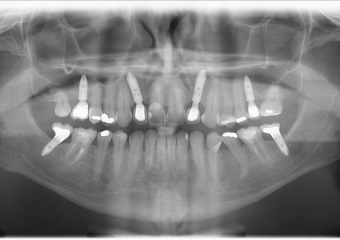Raio X final - Clínica Cliniface