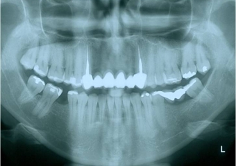 Raio x inicial - Clínica Cliniface