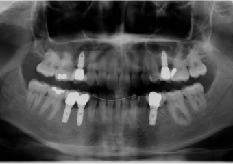 Raio x final - Clínica Cliniface