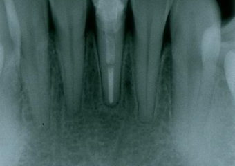 Raio x inicial - Clínica Cliniface