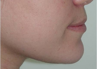 Perfil final - Clínica Cliniface