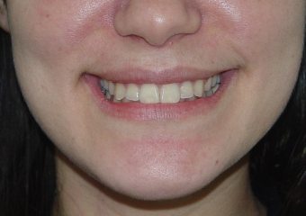 Imagem final - Clínica Cliniface