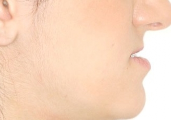 Perfil inicial - Clínica Cliniface