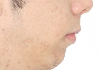 Perfil inicial  - Clínica Cliniface