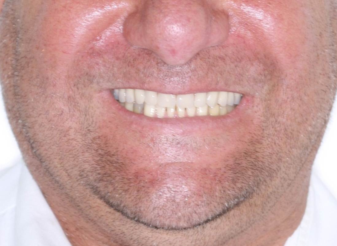 Sorriso final - Clínica Cliniface