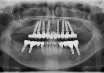 Raio X final - Clínica Cliniface