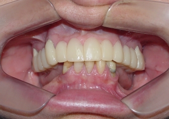 Imagem inicial em 2014 - Clínica Cliniface