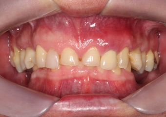 Imagem inicial em 2014 - Clínica Cliniface