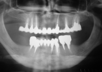 Imagem inicial em 2003 - Clínica Cliniface