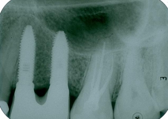 Raio X final - Clínica Cliniface