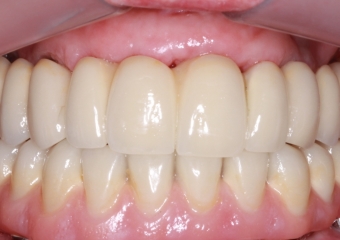 Controle do paciente, em 2016 - Clínica Cliniface