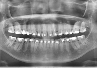 Raio x inicial - Clínica Cliniface