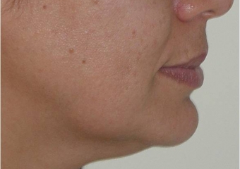 Perfil final - Clínica Cliniface