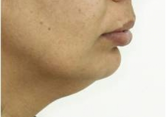 Perfil inicial - Clínica Cliniface