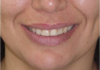 Sorriso final  - Clínica Cliniface
