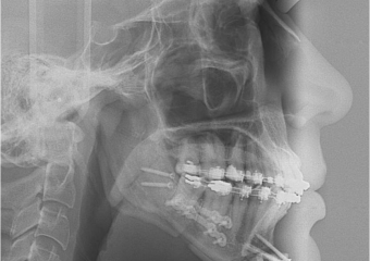 Telerradiografia final - Clínica Cliniface