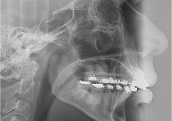 Telerradiografia inicial - Clínica Cliniface
