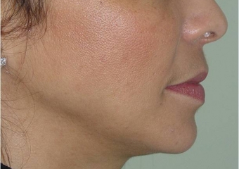 Perfil final - Clínica Cliniface