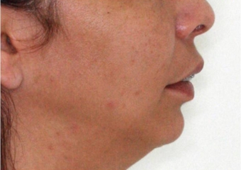 Perfil inicial - Clínica Cliniface