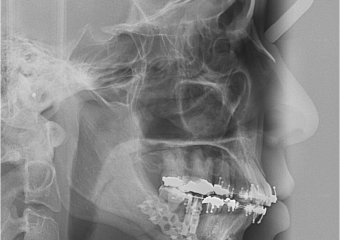 Telerradiografia final - Clínica Cliniface