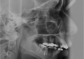 Telerradiografia inicial - Clínica Cliniface