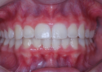 Intra oral Final - 2019 - Clínica Cliniface