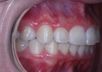 Lateral final - 2019 - Clínica Cliniface