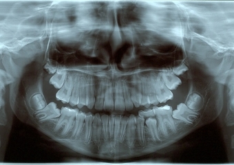 Rx Panorâmico Inicial - Clínica Cliniface
